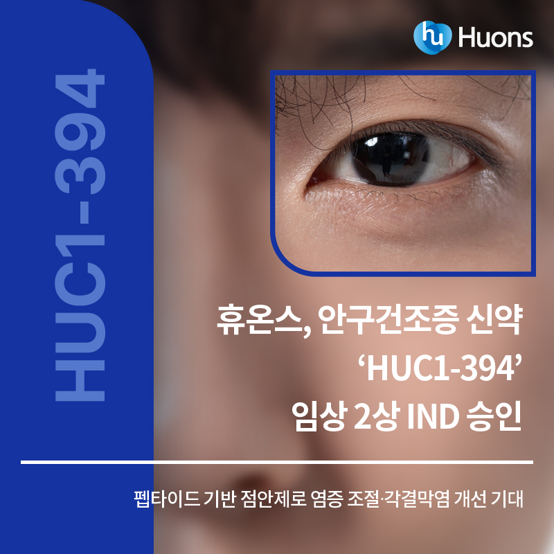 휴온스 네이버 블로그